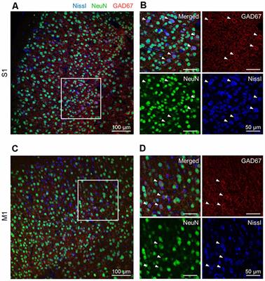 Deep Learning-Based Classification of GAD67-Positive Neurons Without the Immunosignal